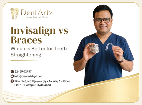 invisalign